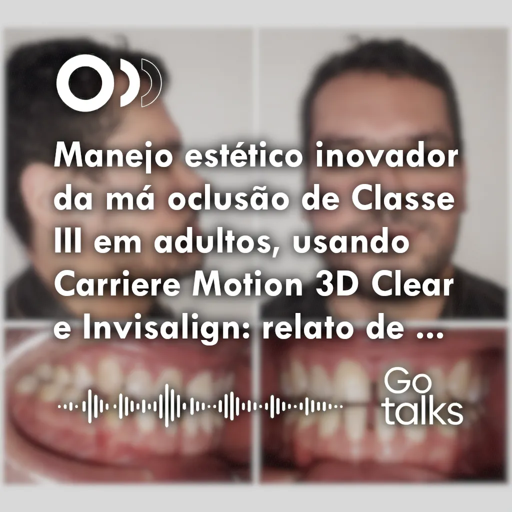 Manejo estético inovador da má oclusão de Classe III em adultos, usando Carriere Motion 3D Clear e Invisalign: relato de caso