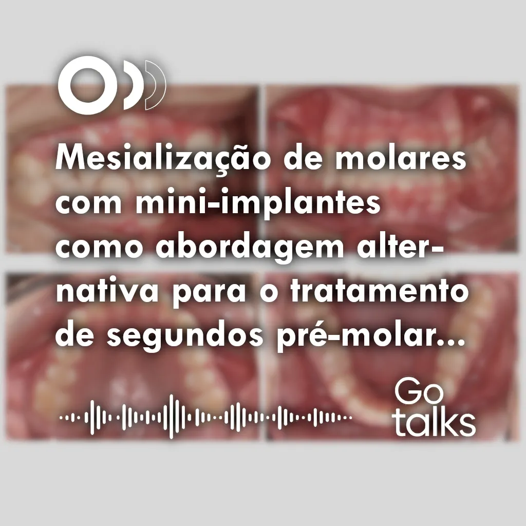 Mesialização de molares com mini-implantes como abordagem alternativa para o tratamento de segundos pré-molares inferiores ausentes: relato de caso