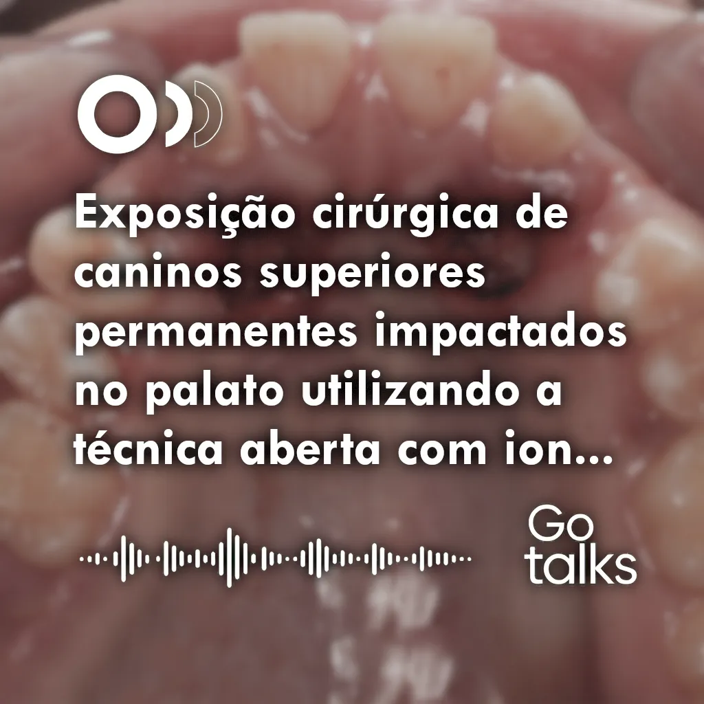Exposição cirúrgica de caninos superiores permanentes impactados no palato utilizando a técnica aberta com ionômero de vidro (GOPEX): relato de caso