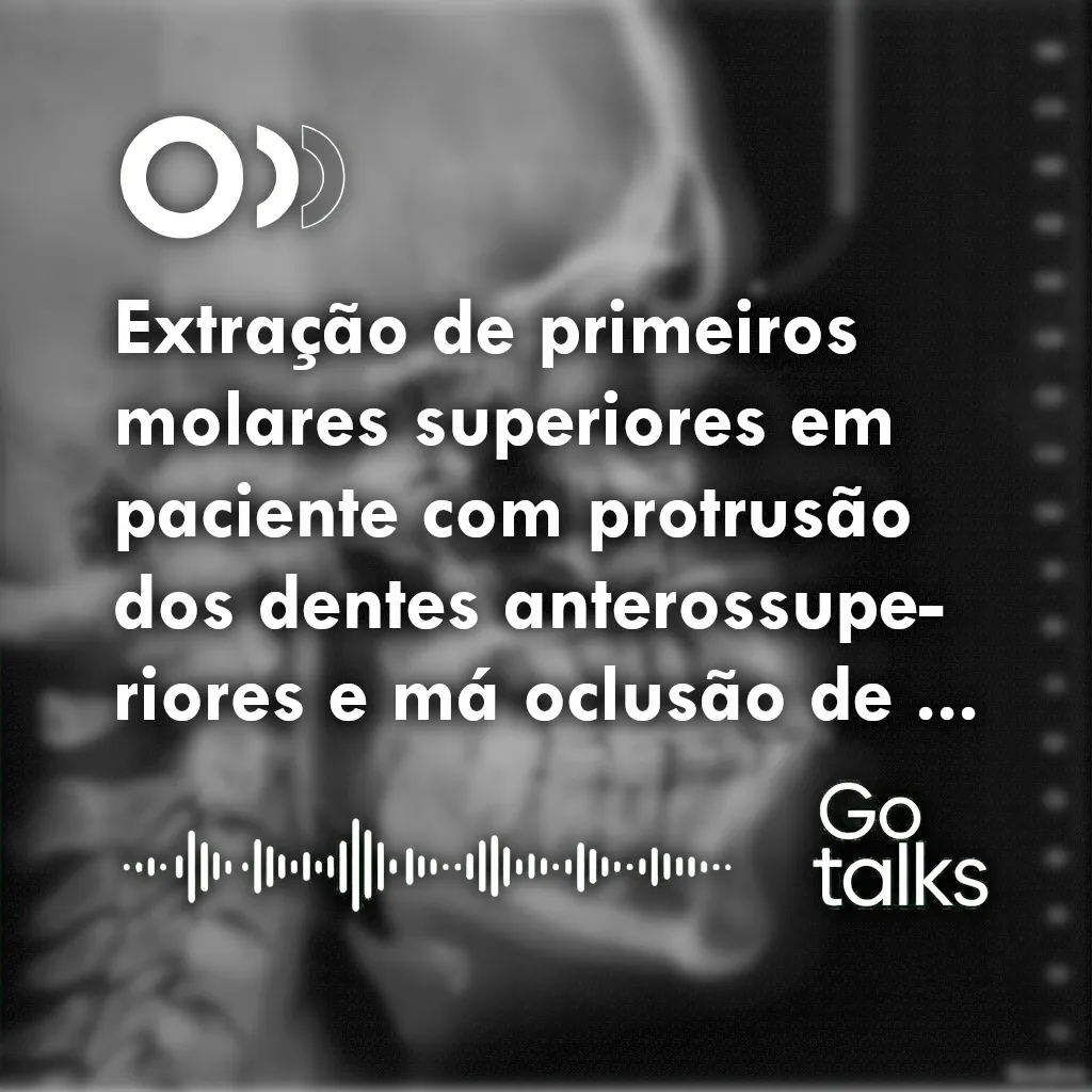 Extração de primeiros molares superiores em paciente com protrusão dos dentes anterossuperiores e má oclusão de Classe II, divisão 1: relato de caso