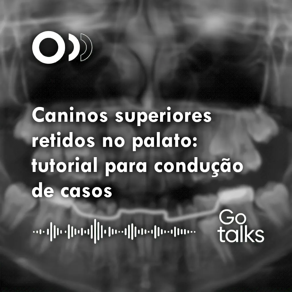 Caninos superiores retidos no palato: tutorial para condução de casos