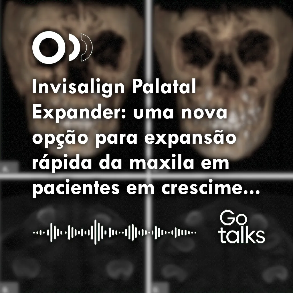 Invisalign Palatal Expander: uma nova opção para expansão rápida da maxila em pacientes em crescimento