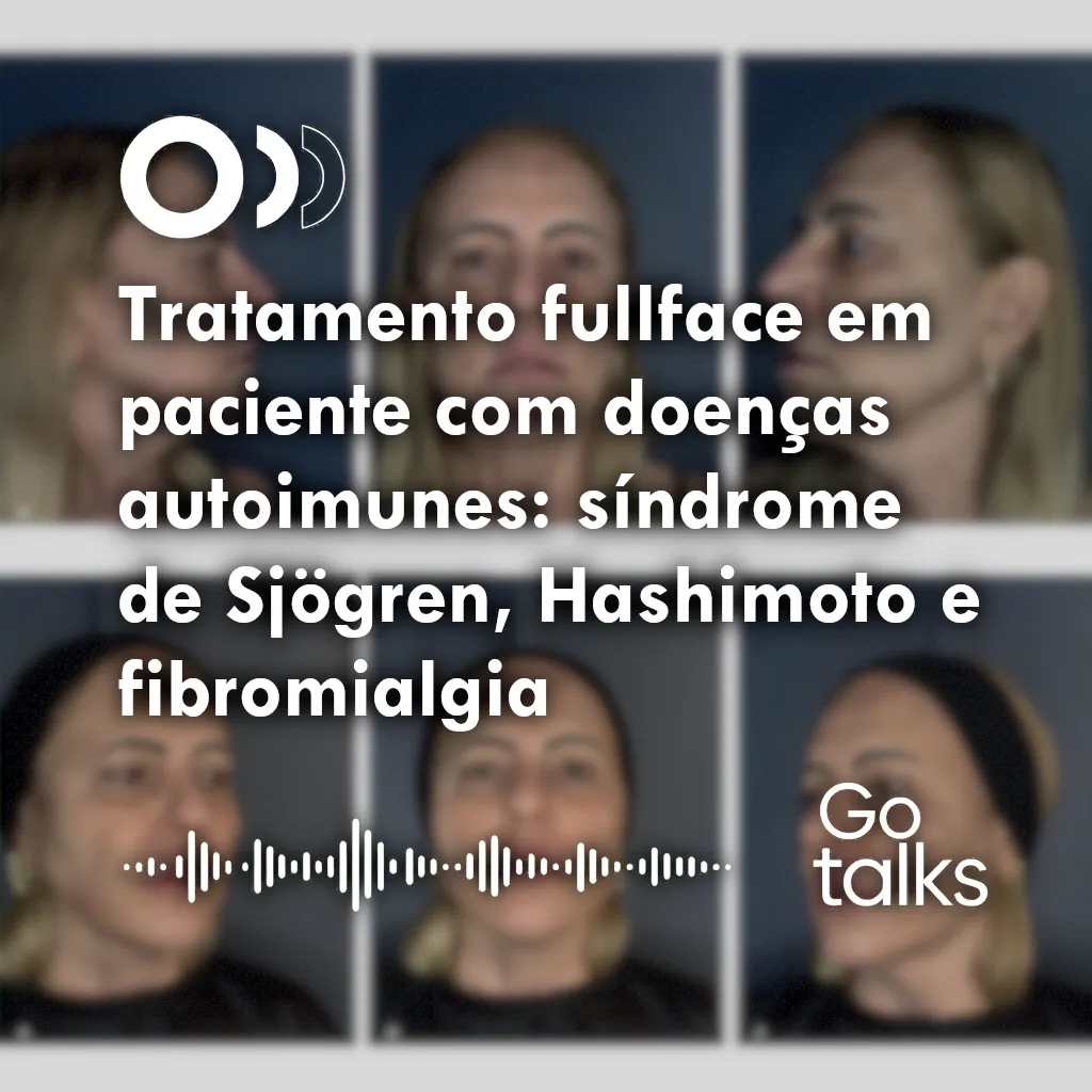 Tratamento fullface em paciente com doenças autoimunes: síndrome de Sjögren, Hashimoto e fibromialgia