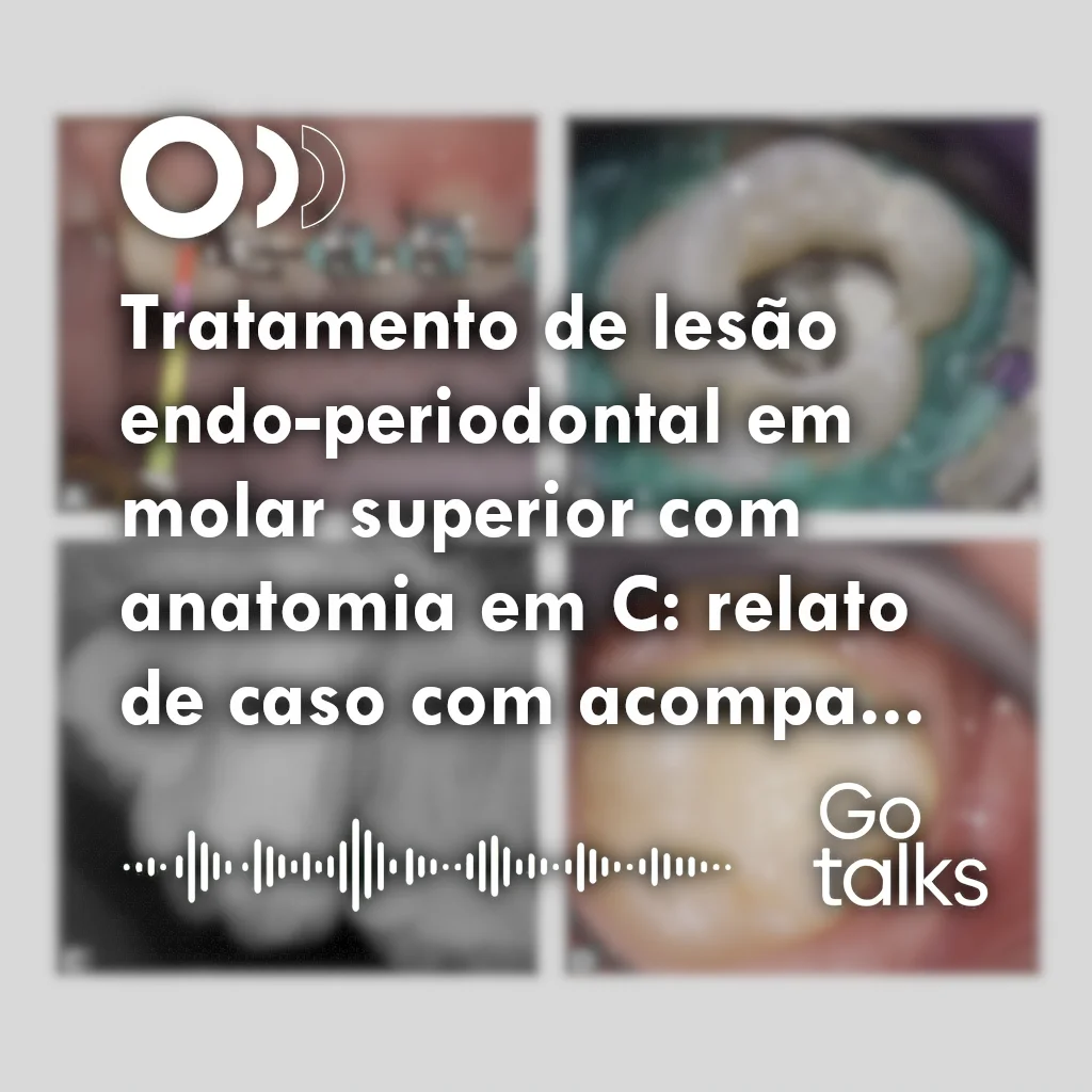 Tratamento de lesão endo-periodontal em molar superior com anatomia em C: relato de caso com acompanhamento tomográfico