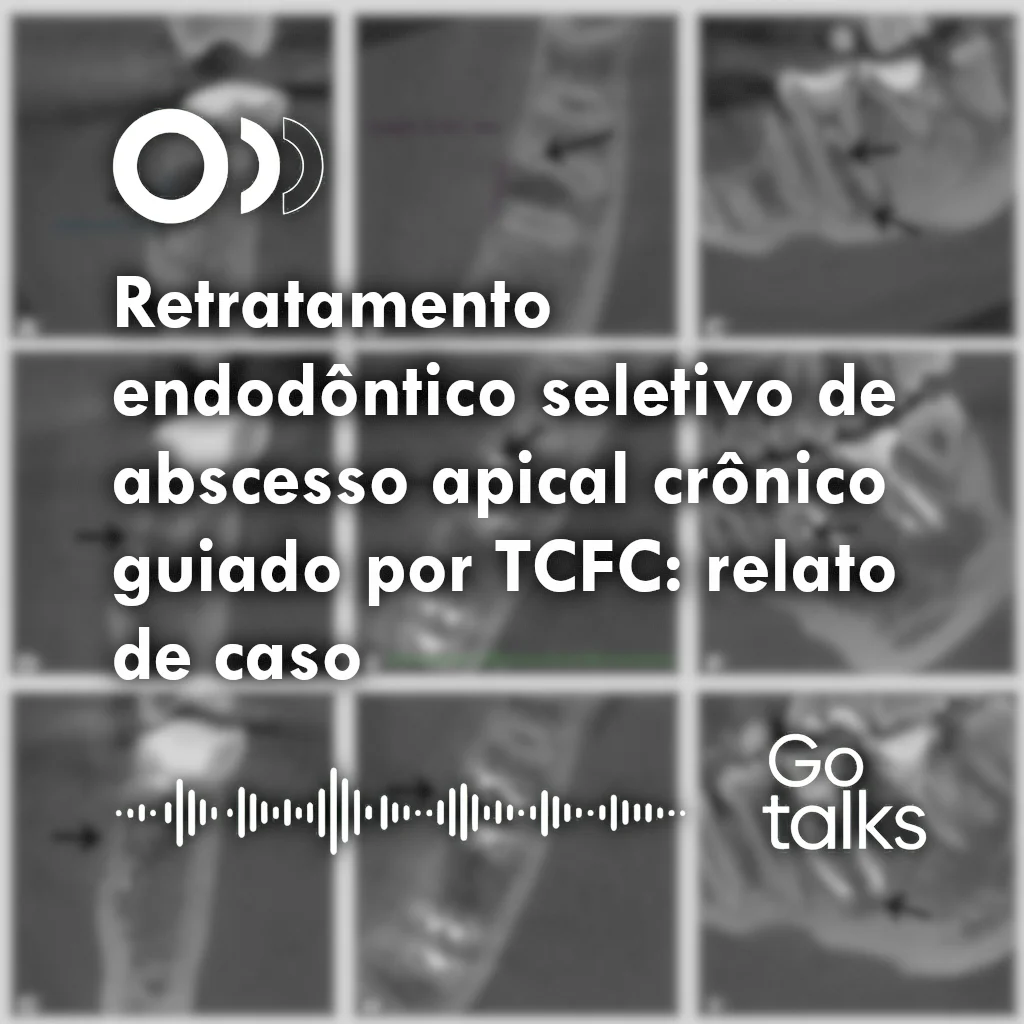 Retratamento endodôntico seletivo de abscesso apical crônico guiado por TCFC: relato de caso