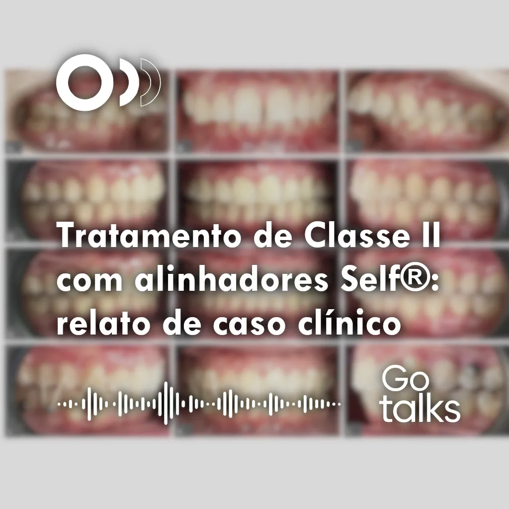 Tratamento de Classe II com alinhadores Self®: relato de caso clínico