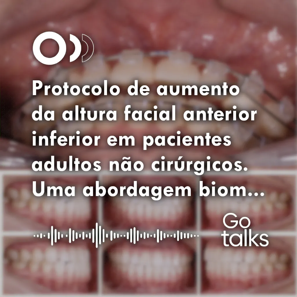 Protocolo de aumento da altura facial anterior inferior em pacientes adultos não cirúrgicos. Uma abordagem biomecânica conservadora, com rotação horária da mandíbula: relato de caso