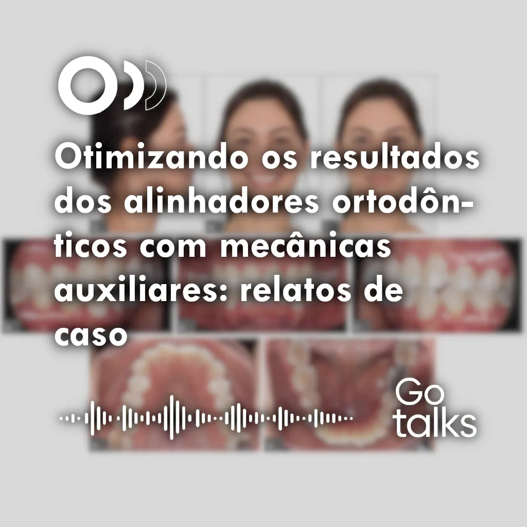 Otimizando os resultados dos alinhadores ortodônticos com mecânicas auxiliares: relatos de caso