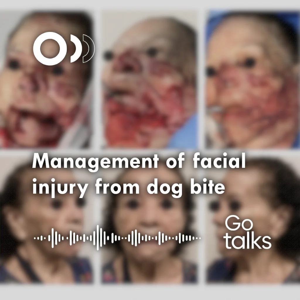 Management of facial injury from dog bite
