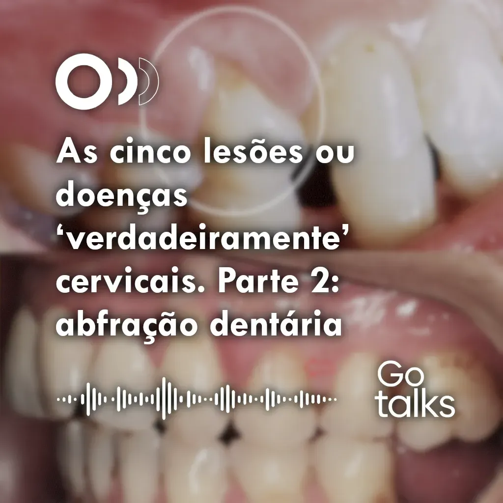 As cinco lesões ou doenças ‘verdadeiramente’ cervicais. Parte 2: abfração dentária