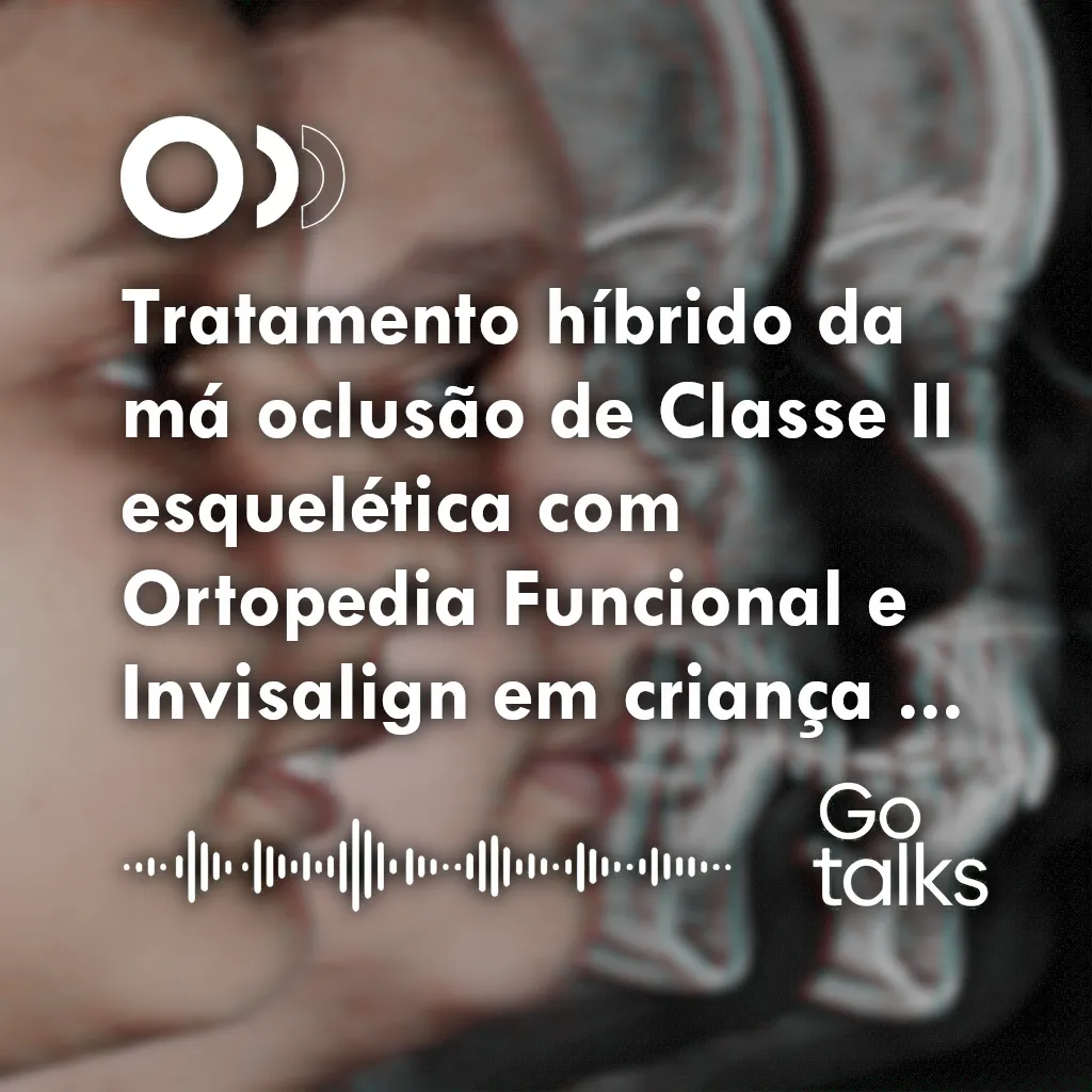 Tratamento híbrido da má oclusão de Classe II esquelética com Ortopedia Funcional e Invisalign em criança com 11 anos de idade
