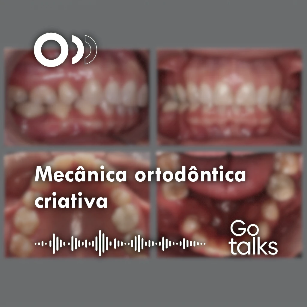 Mecânica ortodôntica criativa