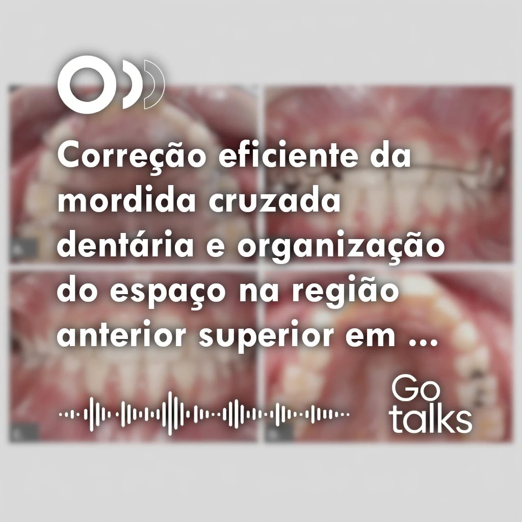 Correção eficiente da mordida cruzada dentária e organização do espaço na região anterior superior em paciente na dentição mista: relato de caso