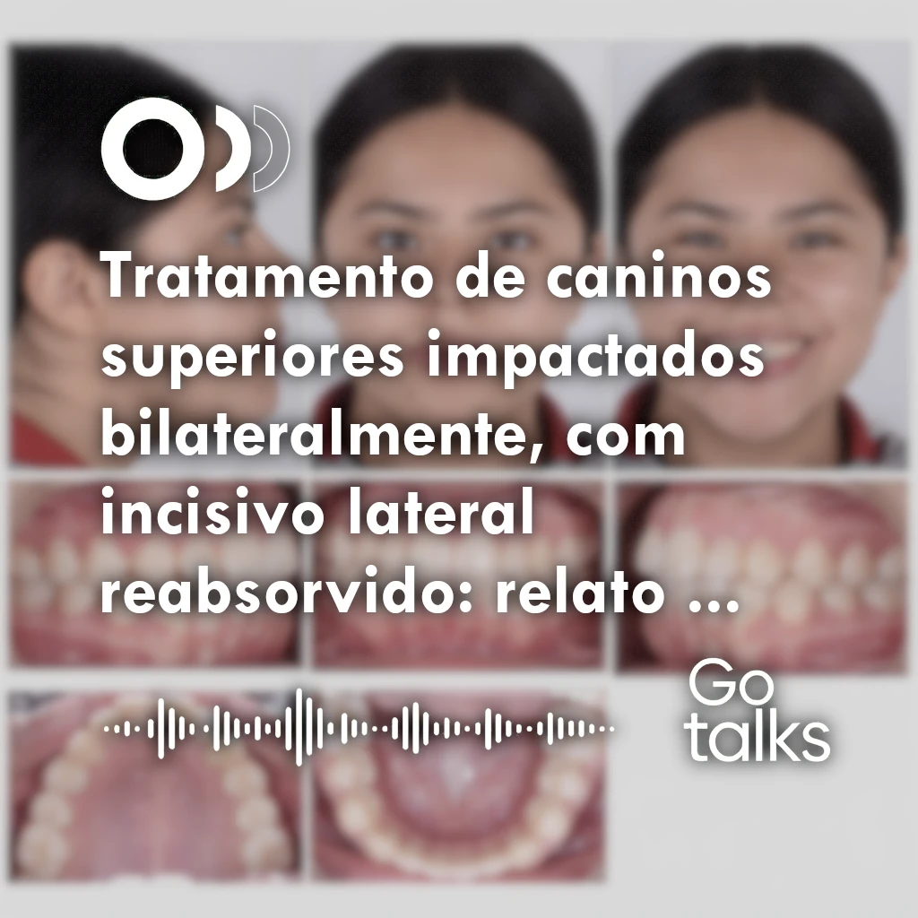 Tratamento de caninos superiores impactados bilateralmente, com incisivo lateral reabsorvido: relato de caso