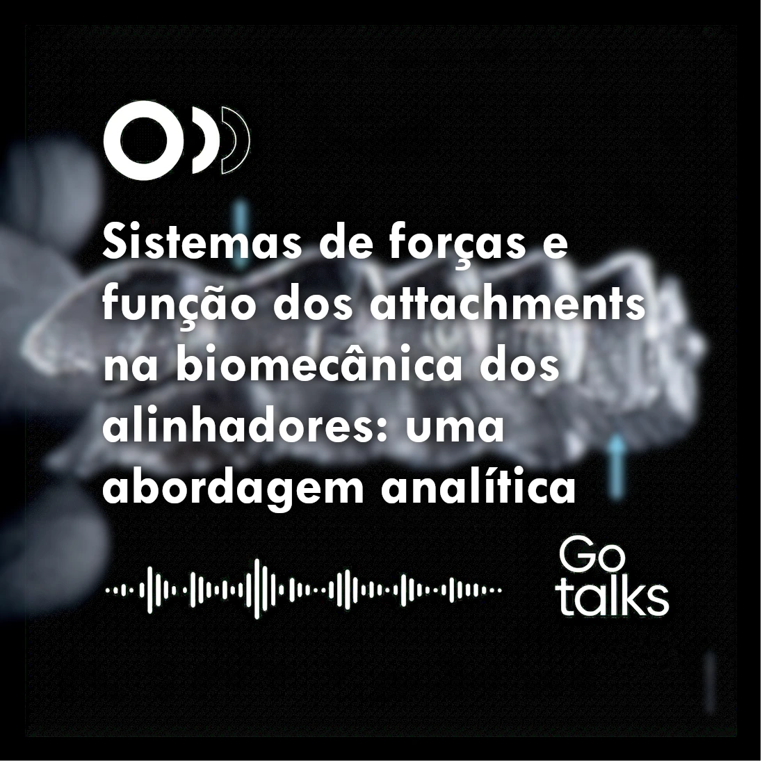 Sistemas de forças e função dos attachments na biomecânica dos alinhadores: uma abordagem analítica