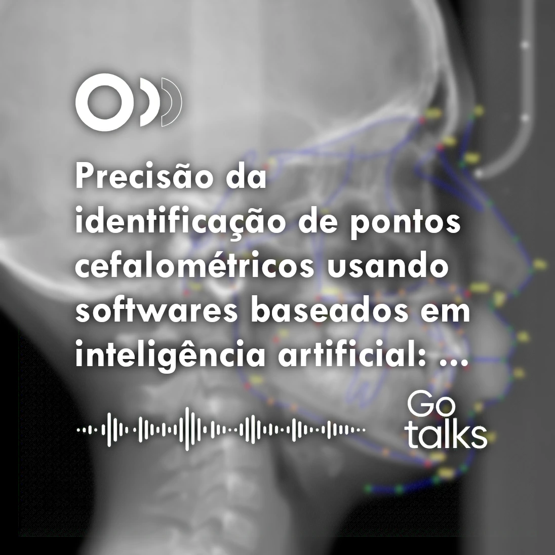Precisão da identificação de pontos cefalométricos usando softwares baseados em inteligência artificial: um estudo comparativo