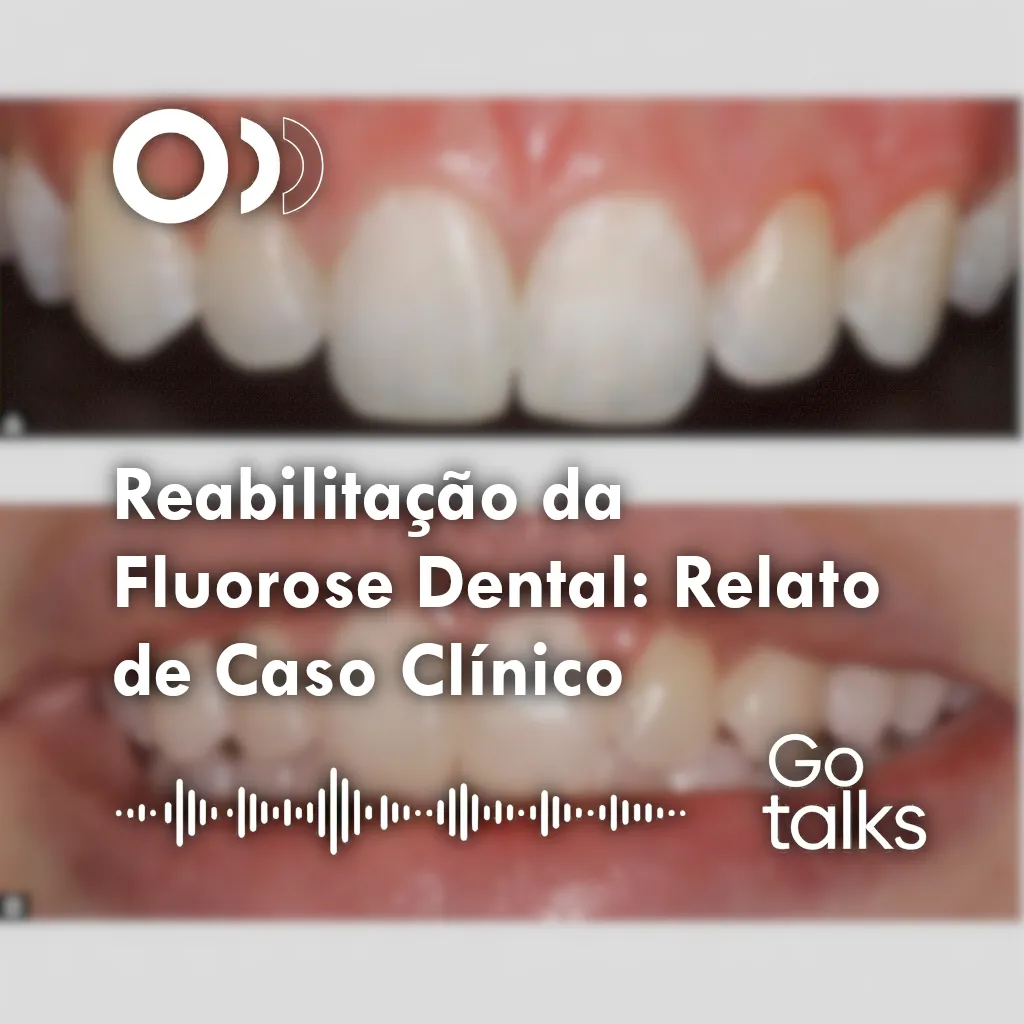 Reabilitação da Fluorose Dental: Relato de Caso Clínico