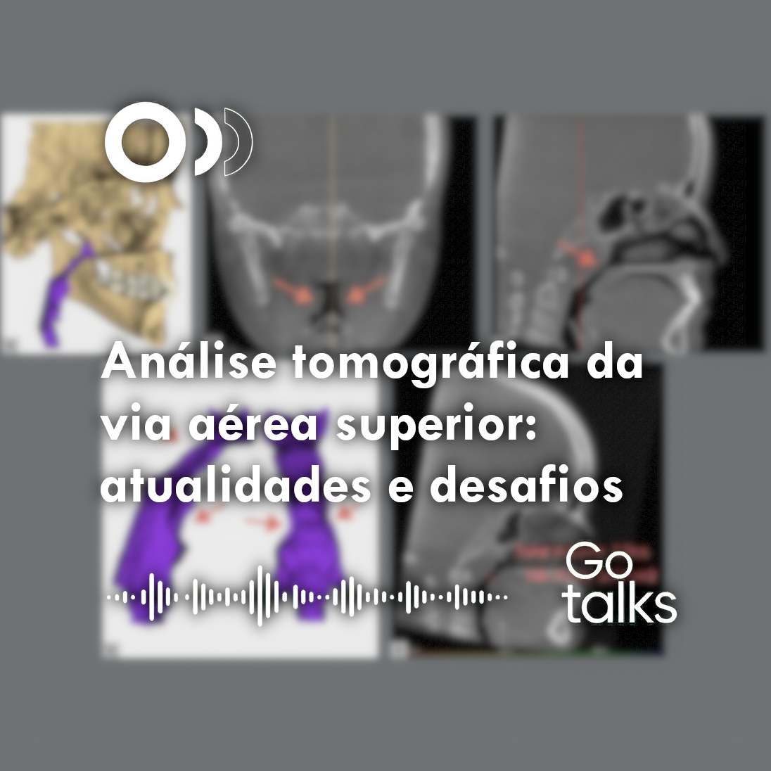 Análise tomográfica da via aérea superior: atualidades e desafios