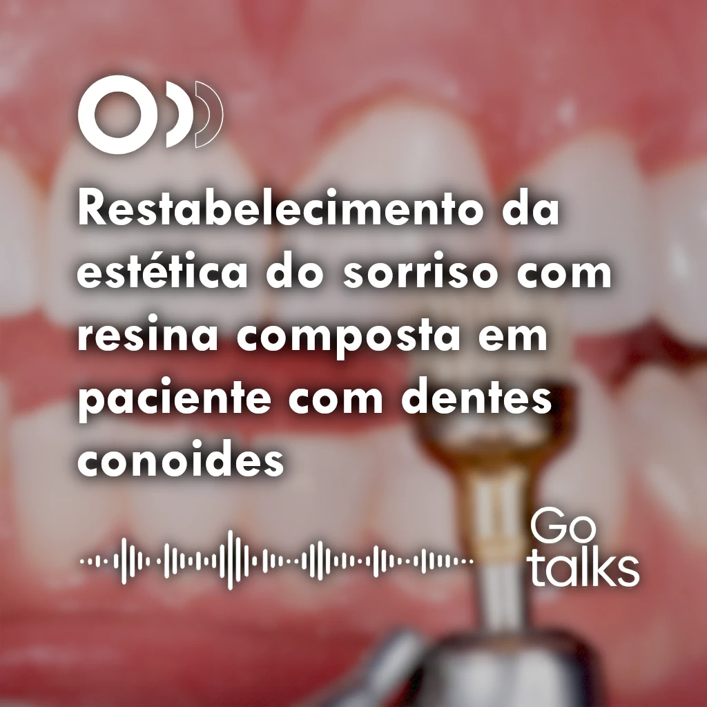 Restabelecimento da estética do sorriso com resina composta em paciente com dentes conoides